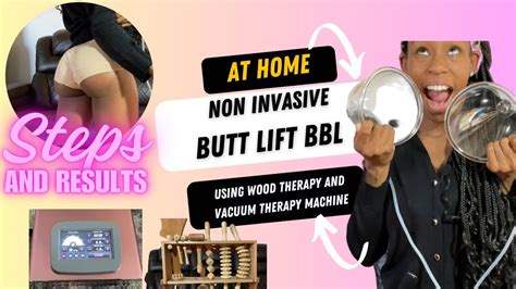 At Home Non Invasive Butt Lift Bbl Using Vacuum And Wood Therapy Vacuum