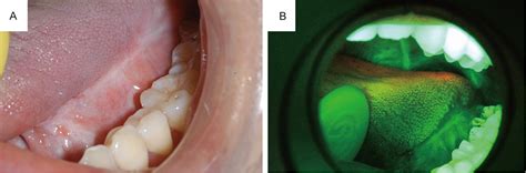 Pdf Non Micro Invasive Clinicopathologic Methods In The Assessment