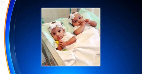 Formerly Conjoined Twins Make First Appearance After Separation Surgery