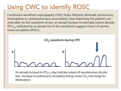 Continuous Waveform Capnography A Crucial Tool For Ed Clinicians