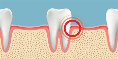 Gum Pain Causes Relief And Treatments Crest Ca