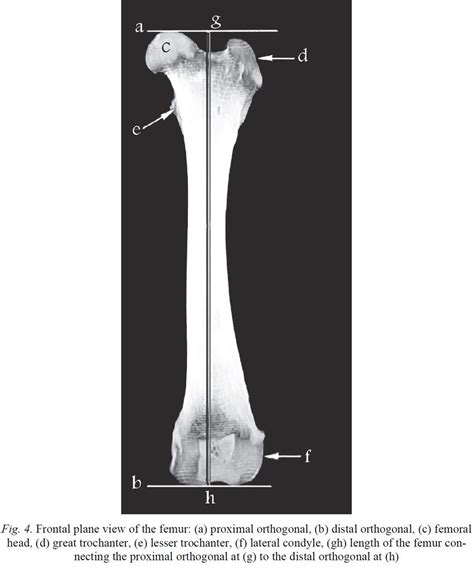 Frontal Plane View Of The Femur A Proximal Orthogonal B Distal