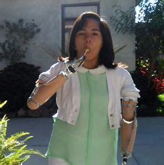 Hook Prosthesis Lady