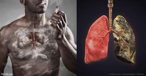 Terrible Effects Of Smoking On Every Organ Of The Body Greenbhl