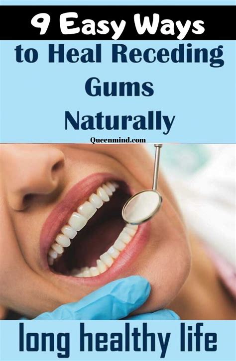9 Easy Ways To Heal Receding Gums Naturally Receding Gums Tooth