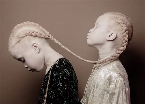 11 Year Old Twins Taking Fashion World By Storm As Models With Albinism