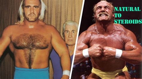 Hulk Hogan Steroid Transformation Wwe Steroids Drugs Steroids Transformation Youtube