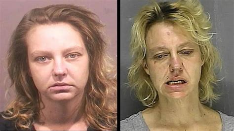 Meth Face Sores Scabs What Meth Does To Your Skin