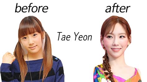 Tae Yeon Before And After Youtube