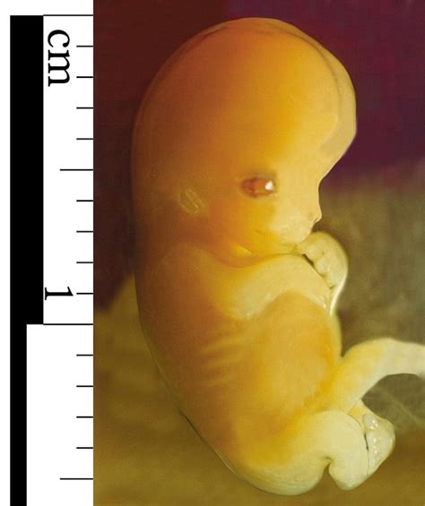 Human Fetal Development Stages Week To Week
