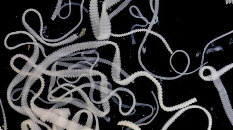 What Is The Longest Tapeworm Ever Recorded