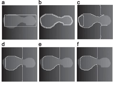 Figure 2 From A Local Region Based Chan Vese Model For Image
