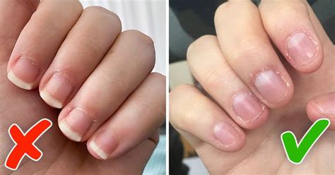 10 Tips To Stop Biting Your Nails Once And For All Bright Side