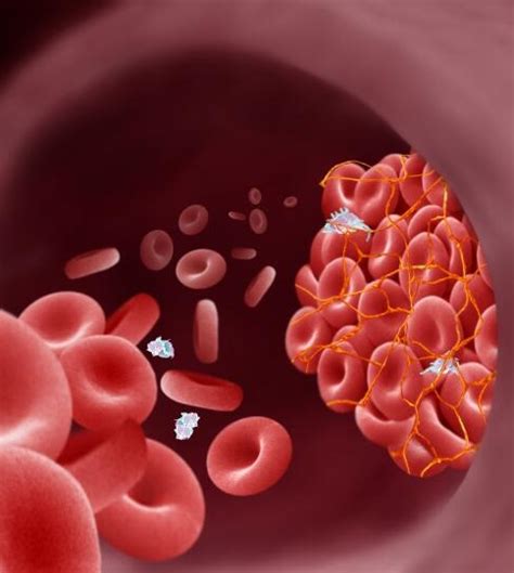 Functions Of Blood Clotting Nhs Blood Donation