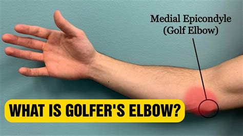 Understanding Golfers Elbow And How To Fix It Youtube