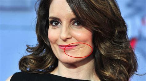 15 Famous Deformities Of Celebs Finally Explained