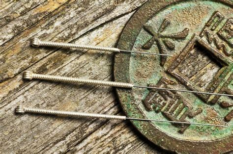 5 Health Benefits Of Acupuncture You Didnt Know About Integrative