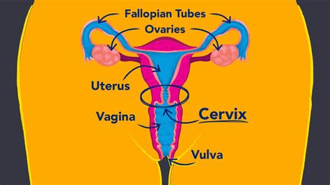 High Vs Low Cervix
