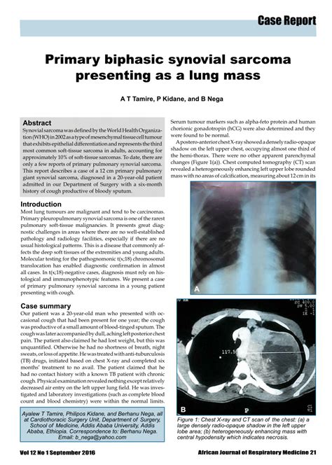 PDF Primary Biphasic Synovial Sarcoma Presenting As A Lung Mass