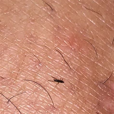 Identifying Little Black Biting Bugs Thriftyfun