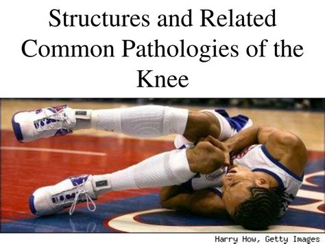 Ppt Structures And Related Common Pathologies Of The Knee Powerpoint Presentation Id