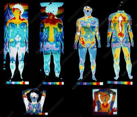 Human Body Thermograms Stock Image P8000118 Science Photo Library