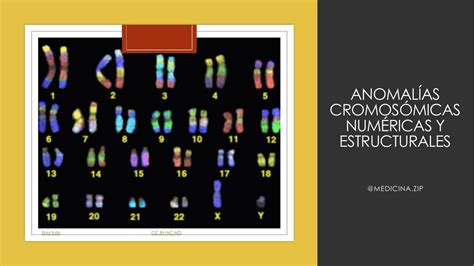 Resúmenes De Anomalías Cromosómicas Descarga Apuntes De Anomalías