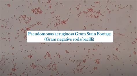 Gram Negative Rods Of Pseudomonas Aeruginosa Pseudomonas Aeruginosa