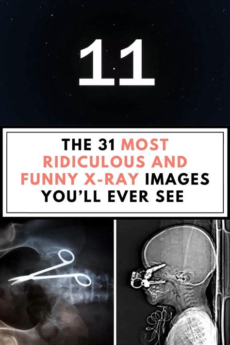 The 31 Most Ridiculous And Funny X Ray Images Youll Ever See Video