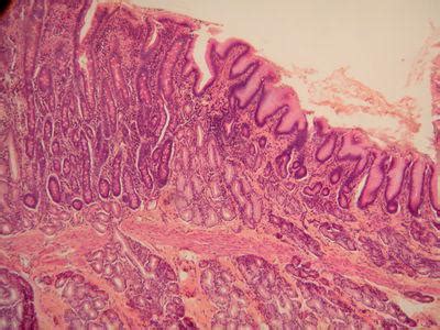 Durch den verkürzten darm wird die nahrung nur noch eingeschränkt resorbiert. Magen: Histologie, Entwicklung und Struktur