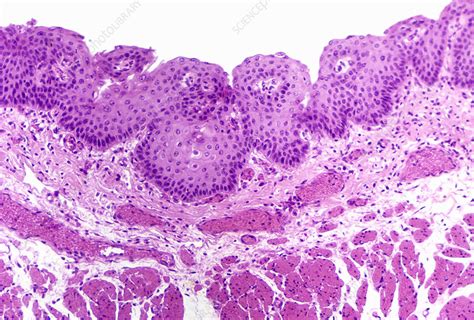 Cross Section Of The Human Esophagus Lm Stock Image C0052749