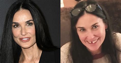 The Bizarre Story Of How Demi Moore S Teeth Fell Out