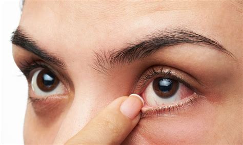 Diabetes And Eye Problems Eye Diseases