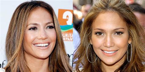 Jennifer Lopez Nose Job Before And After Pictures 2018 Plastic