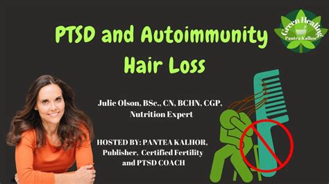 Ptsd And Autoimmunity Hair Loss Youtube