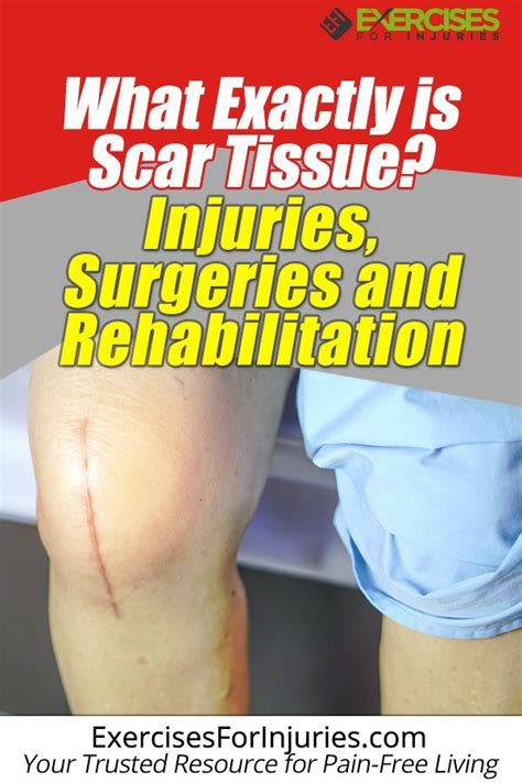 How To Break Up Scar Tissue After Knee Replacement References Sho News