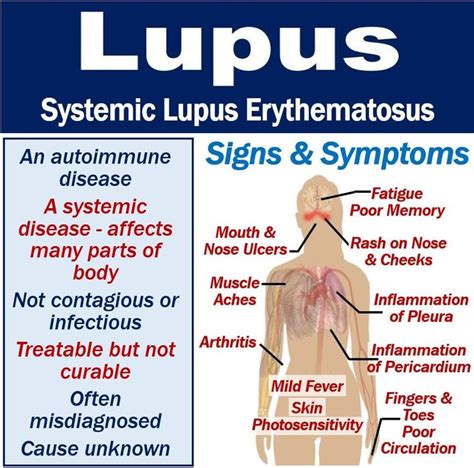 Daily Lupus Awareness Fact Of The Day Lupus Facts Lupus Awareness