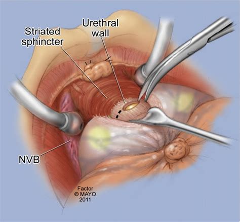 Academic Learning Of Urology Procedures Videos