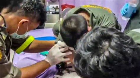 Thailand Man Nearly Lost His Penis After It Became Stuck In Metal Ring World News Metro News