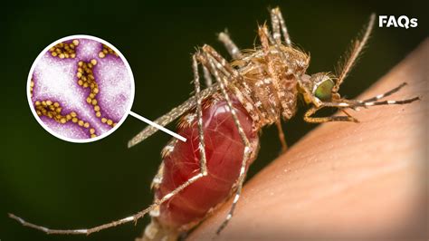 Mosquito Season How To Identify Symptoms Of West Nile Virus