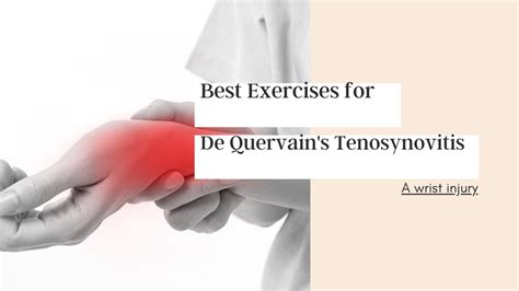 Best Exercises For De Quervain S Tenosynovitis YouTube