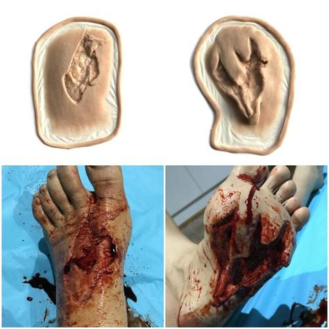 Entry Exit Gunshot Foot Wound Silicone Prosthetic By