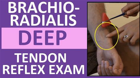 Brachioradialis Deep Tendon Reflex Examination Nursing Head To Toe Assessment Youtube
