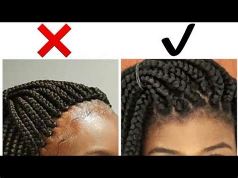 7 accessible vibrators you can use with just one hand. Tight braids? How to loosen tight braids!! - YouTube