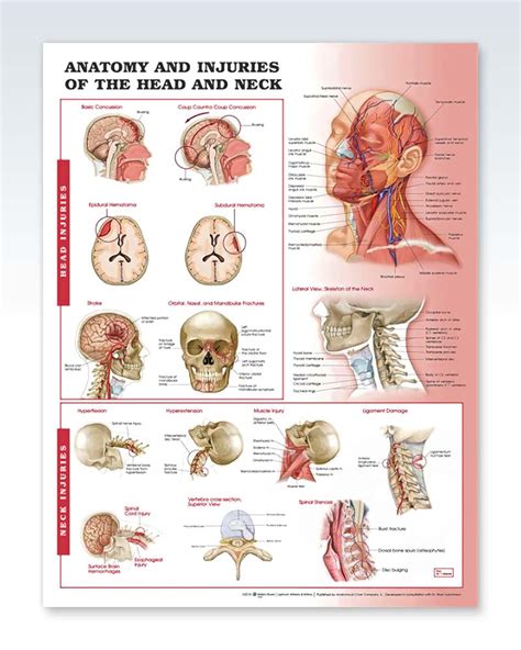 Injuries Of The Head And Neck Exam Room Anatomy Poster Clinicalposters