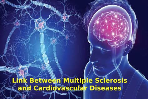 Link Between Multiple Sclerosis And Cardiovascular Diseases