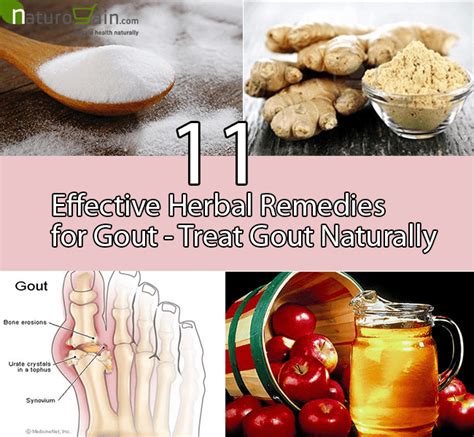 11 Effective Herbal Remedies For Gout Treat Gout Naturally