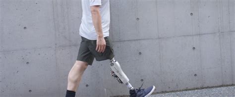 Powered Prosthetic Leg Developer Bionicm Secures 5m In Series A Funding