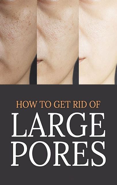 How To Get Rid Of Large Pores Your Decision Depends On Your Age