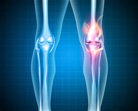 Burning Stabbing And Pain On Inside Of Knee Causes And Best Treatment